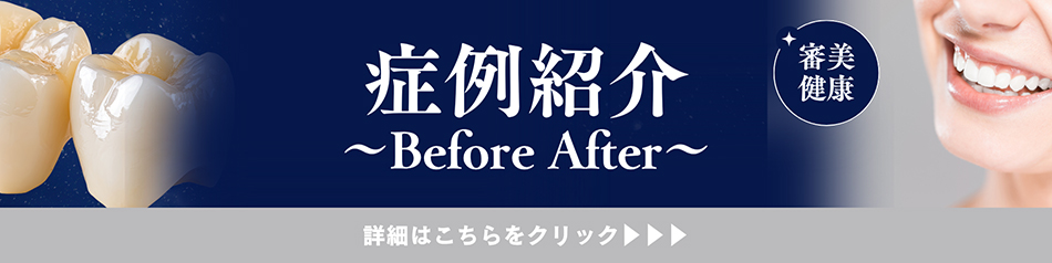 症例紹介